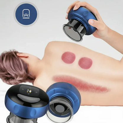 Electric Cupping Device